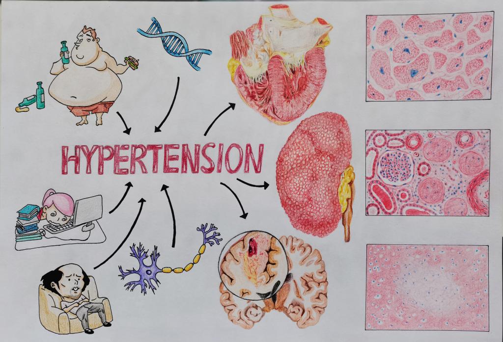 1. 邮寄手绘 作品分类 2 高血压的“前因后果” 91吃瓜
 鲁逸名